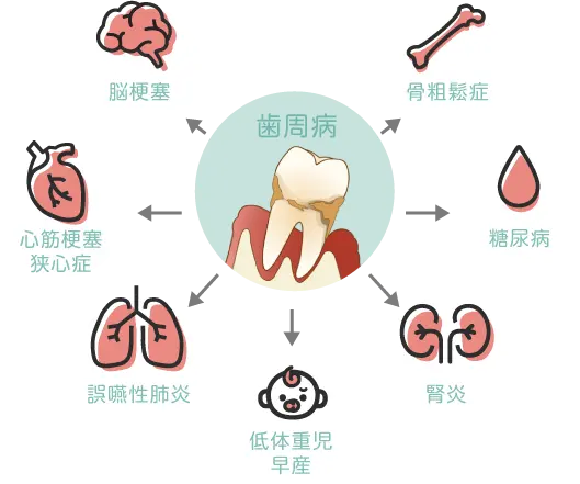 全身疾患への影響