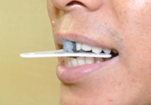 歯の噛み合わせ検査