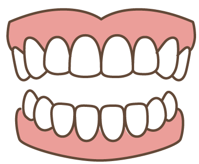 全歯欠損に対する総入れ歯