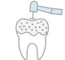 歯石を除去したい