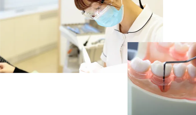 歯周基本検査