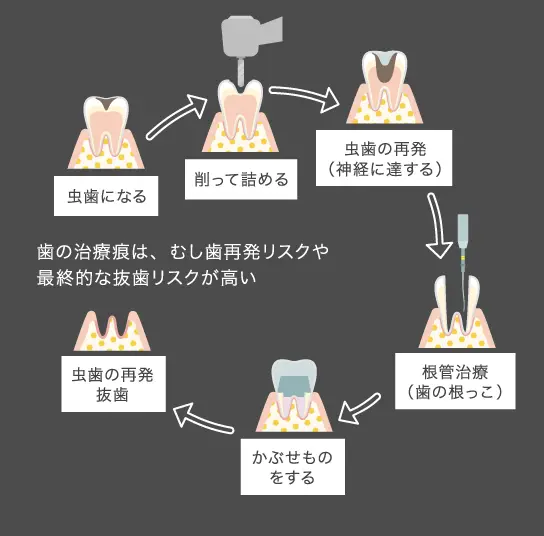 むし歯から抜歯まで