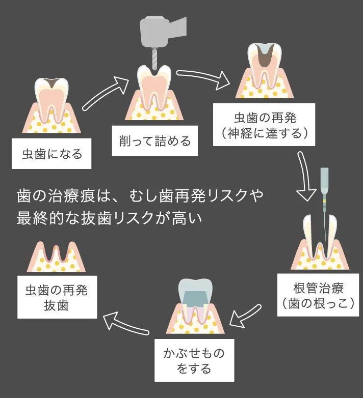 むし歯から抜歯まで